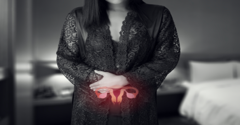 Çikolata Kistleri (Endometriozis) Nedir?